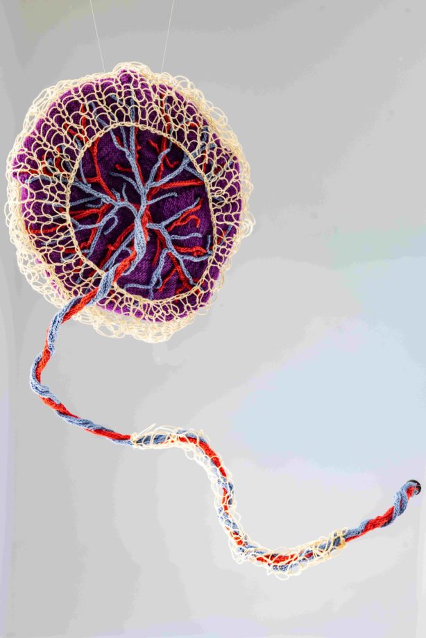 Placenta with blood vessels amniotic membrane and umbilical cord (2025)